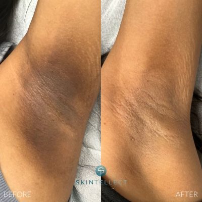 737b7509-7fe2-46d3-81c7-6d6043ef956e