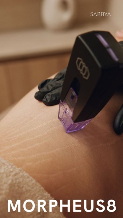 b7735755-8850-44ab-a79c-7e8c388854fa